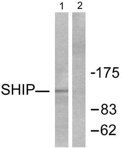 Anti-SHIP1 antibody