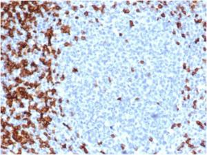 Immunohistochemical analysis of formalin-fixed, paraffin-embedded human tonsil using Anti-CD7 Antibody [CD7/6388R]