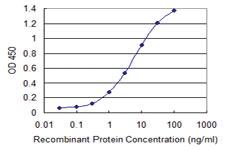 Anti-CDHR3 Mouse Monoclonal Antibody [clone: 1B11]