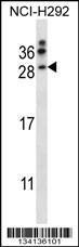 Anti-NRTN Rabbit Polyclonal Antibody