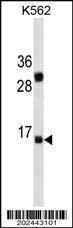 Anti-IL2 Mouse Monoclonal Antibody [clone: 627CT14.8.1]