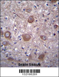 Anti-PPP3CC Rabbit Polyclonal Antibody (FITC (Fluorescein Isothiocyanate))