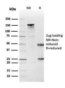 SDS-PAGE analysis of Anti-Cystatin A Antibody [CSTA/3553] under non-reduced and reduced conditions; showing intact IgG and intact heavy and light chains, respectively. SDS-PAGE analysis confirms the integrity and purity of the antibody.