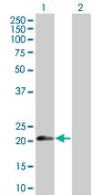 Anti-RAB17 Mouse Polyclonal Antibody