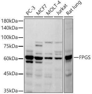 Anti-FPGS Rabbit Monoclonal Antibody [clone: ARC2964]