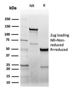 SDS-PAGE analysis of Anti-CD7 Antibody [CD7/6388R] under non-reduced and reduced conditions; showing intact IgG and intact heavy and light chains, respectively. SDS-PAGE analysis confirms the integrity and purity of the antibody