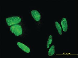 Anti-CDHR3 Mouse Monoclonal Antibody [clone: 8E8]