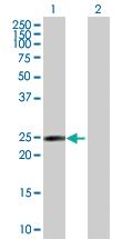 Anti-RAB17 Rabbit Polyclonal Antibody