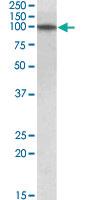 Anti-TXNDC11 Goat Polyclonal Antibody