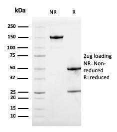 SDS-PAGE analysis of Anti-Calprotectin Antibody [S100A9/1075] under non-reduced and reduced conditions; showing intact IgG and intact heavy and light chains, respectively. SDS-PAGE analysis confirms the integrity and purity of the antibody