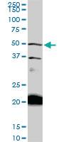 Anti-NADK Mouse Monoclonal Antibody [clone: 5F4]