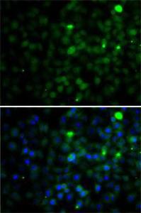 Antibody anti-SMYD4 100 µl