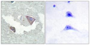 Immunohistochemical analysis of paraffin-embedded human brain using Anti-PDGFR alpha (phospho Tyr754) Antibody. The right hand panel represents a negative control, where the antibody was pre-incubated with the immunising peptide