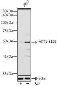 Western blot analysis of extracts of 293T cells, using Anti-AKT1 (phospho Ser129) Antibody (A305611) at 1:500 dilution