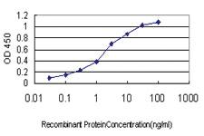 Anti-CDHR3 Mouse Monoclonal Antibody [clone: 8E8]