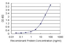 Anti-CENPH Polyclonal Antibody Pair