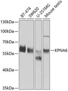 Western blot analysis of extracts of various cell lines, using Anti-KPNA6 Antibody (A12105) at 1:1,000 dilution The secondary antibody was Goat Anti-Rabbit IgG H&L Antibody (HRP) at 1:10,000 dilution Lysates/proteins were present at 25 µg per lane