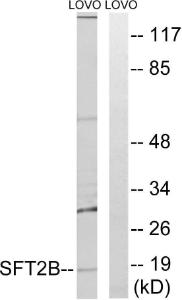 Anti-SFT2B Rabbit Polyclonal Antibody