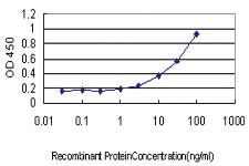 Anti-PHKG1 Mouse Monoclonal Antibody [clone: 2B4]