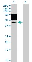 Anti-CD96 Rabbit Polyclonal Antibody