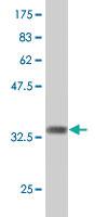 Anti-B3GAT1 Mouse Polyclonal Antibody