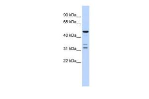 Anti-HTRA4 Rabbit Polyclonal Antibody