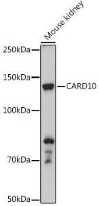 Western blot analysis of extracts of Mouse kidney, using Anti-Carma 3 Antibody (A12107) at 1:500 dilution. The secondary antibody was Goat Anti-Rabbit IgG H&L Antibody (HRP) at 1:10,000 dilution.