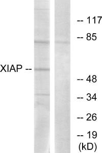 Western blot analysis of lysates from 293 cells using Anti-XIAP Antibody. The right hand lane represents a negative control, where the antibody is blocked by the immunising peptide