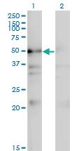 Anti-NADK Mouse Monoclonal Antibody [clone: 5F4]