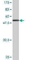 Anti-SNX6 Mouse Monoclonal Antibody [clone: 3B11]