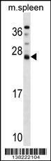 Anti-DNAJC5B Rabbit Polyclonal Antibody