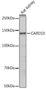 Western blot analysis of extracts of Rat kidney, using Anti-Carma 3 Antibody (A12107) at 1:500 dilution. The secondary antibody was Goat Anti-Rabbit IgG H&L Antibody (HRP) at 1:10,000 dilution.