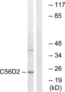 Western blot analysis of lysates from Jurkat cells using Anti-C56D2 Antibody. The right hand lane represents a negative control, where the antibody is blocked by the immunising peptide