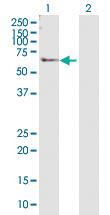 Anti-PHKG2 Rabbit Polyclonal Antibody