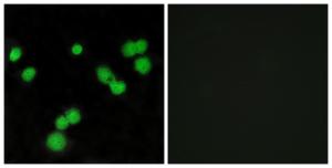 Immunofluorescence analysis of MCF7 cells using Anti-SFRS5 Antibody. The right hand panel represents a negative control, where the antibody was pre-incubated with the immunising peptide