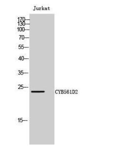 Western blot analysis of Jurkat cells using Anti-C56D2 Antibody