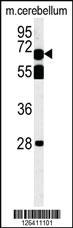 Anti-TBKB1 Rabbit Polyclonal Antibody