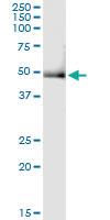 Anti-PHKG2 Rabbit Polyclonal Antibody