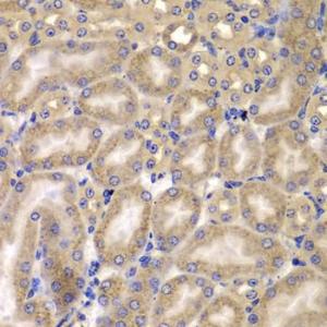 Immunohistochemistry analysis of paraffin-embedded mouse kidney using Anti-Carma 3 Antibody (A12107) at a dilution of 1:100 (40x lens). Perform microwave antigen retrieval with 10 mM PBS buffer pH 7.2 before commencing with IHC staining protocol.