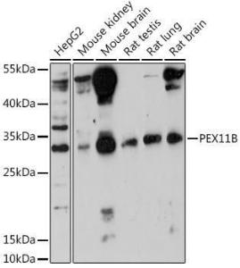 Western blot analysis of extracts of various cell lines, using Anti-PEX11B Antibody (A305613) at 1:1,000 dilution