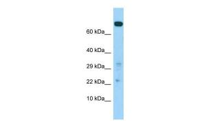 Anti-COASY Rabbit Polyclonal Antibody