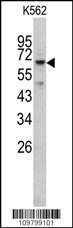 Anti-RIOK1 Rabbit Polyclonal Antibody (PE (Phycoerythrin))