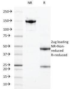 Anti-Calprotectin antibody