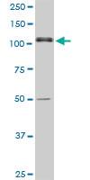 Anti-ASPH Mouse Polyclonal Antibody