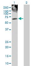 Anti-PHKG2 Rabbit Polyclonal Antibody