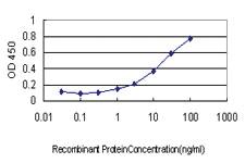 Anti-RAB17 Mouse Monoclonal Antibody [clone: 2B7]