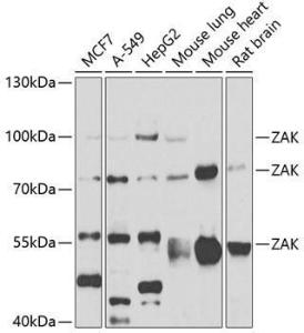 Western blot analysis of extracts of various cell lines, using Anti-ZAK Antibody (A12109) at 1:1,000 dilution. The secondary antibody was Goat Anti-Rabbit IgG H&L Antibody (HRP) at 1:10,000 dilution.