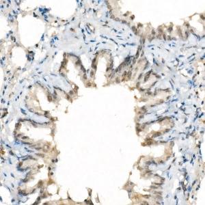 Immunohistochemistry analysis of paraffin-embedded rat lung using Anti-TAZ Antibody [ARC57803] (A309490) at a dilution of 1:100 (40X lens). Perform high pressure antigen retrieval with 10 mM citrate buffer pH 6.0 before commencing with IHC staining protocol