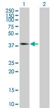 Anti-ASPH Mouse Polyclonal Antibody