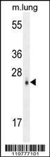 Anti-CEBPD Rabbit Polyclonal Antibody (FITC (Fluorescein Isothiocyanate))